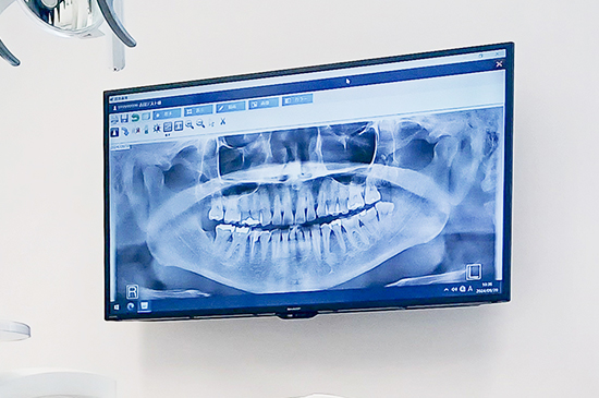 説明用モニター・説明用ツール